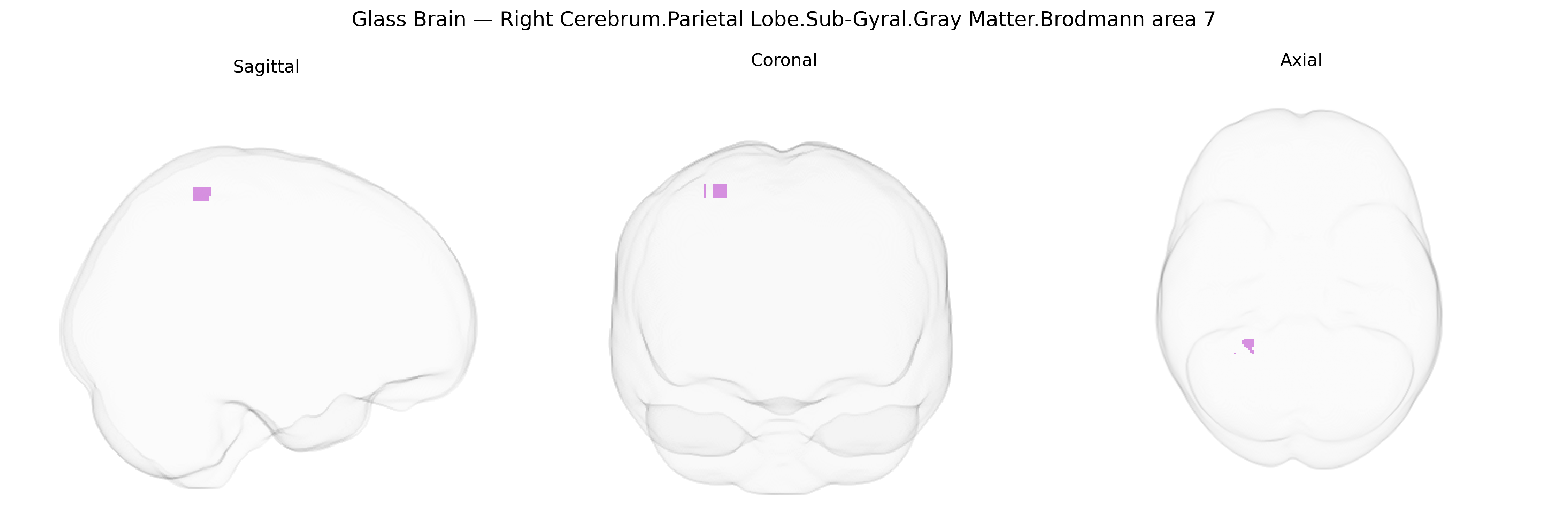 Triplanar Ghost Brain