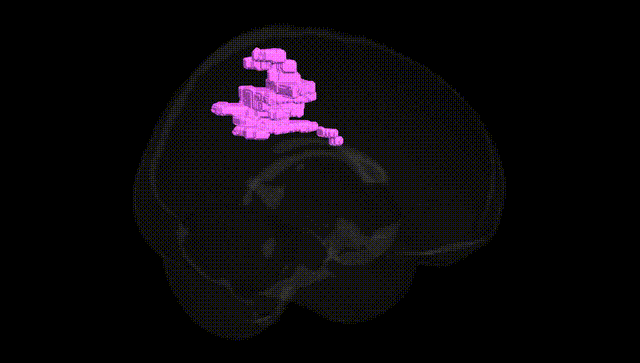 Full Brain Black