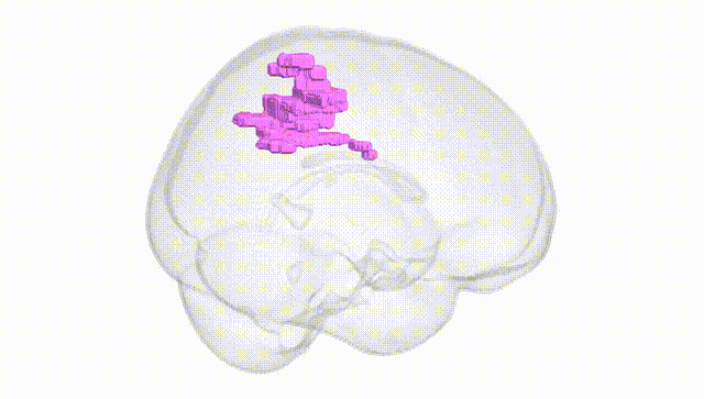 Full Brain White