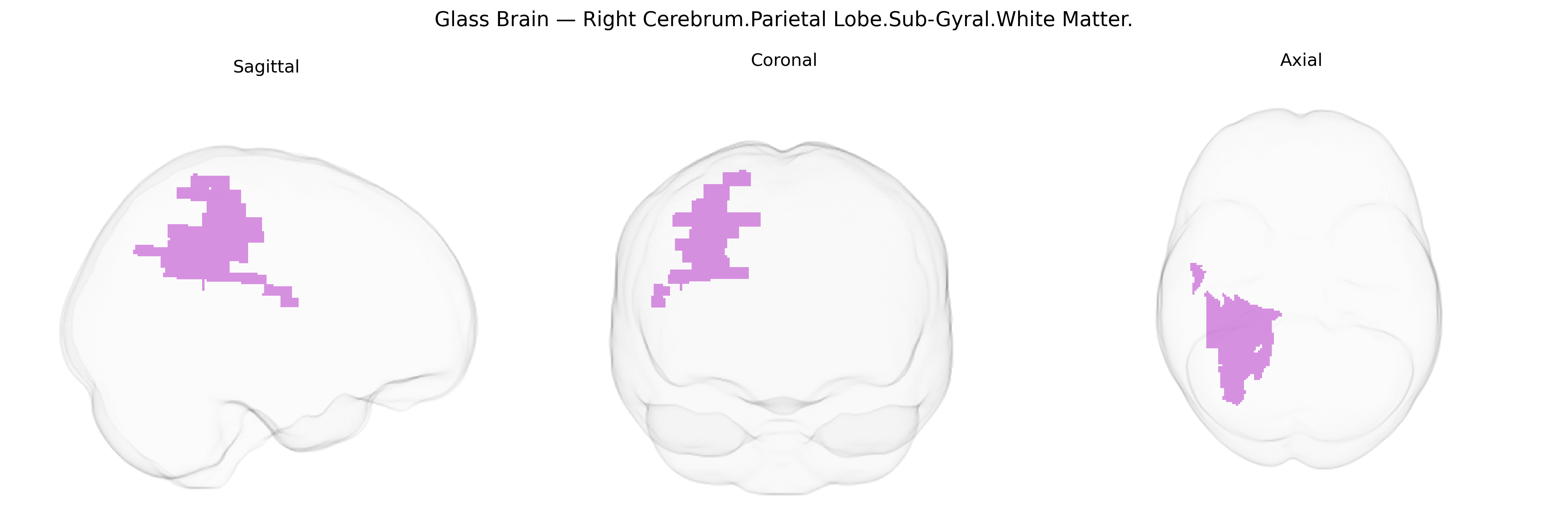 Triplanar Ghost Brain