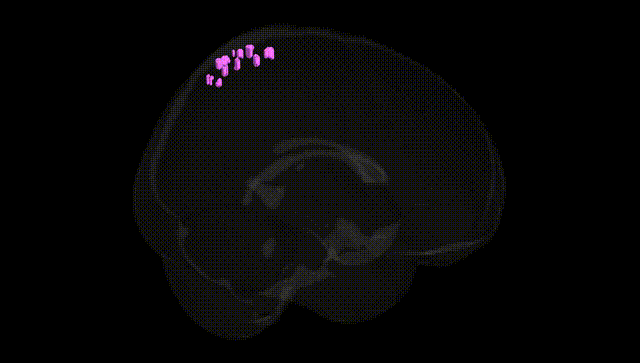 Full Brain Black