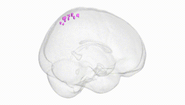 Full Brain White