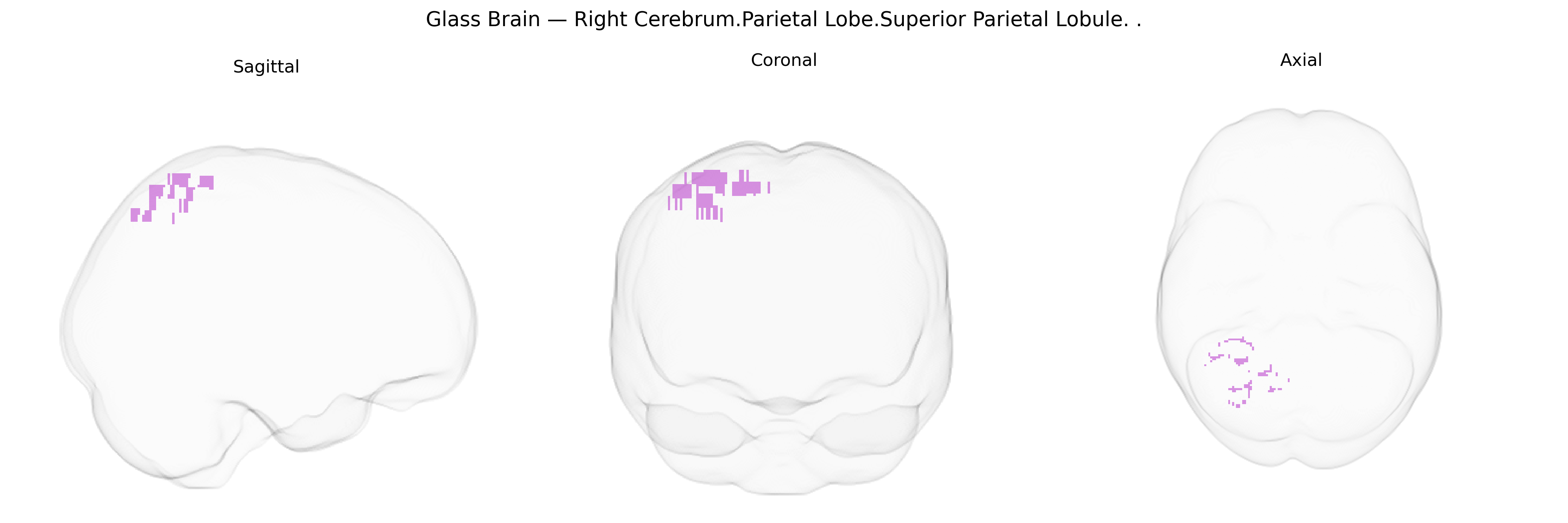 Triplanar Ghost Brain