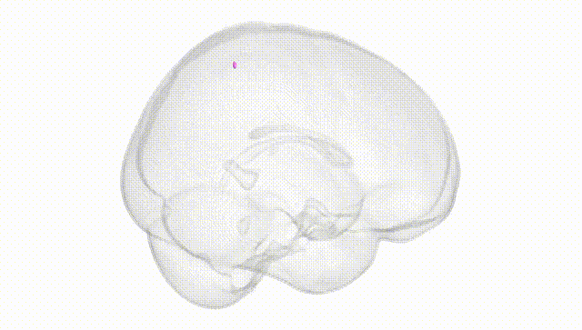 Full Brain White