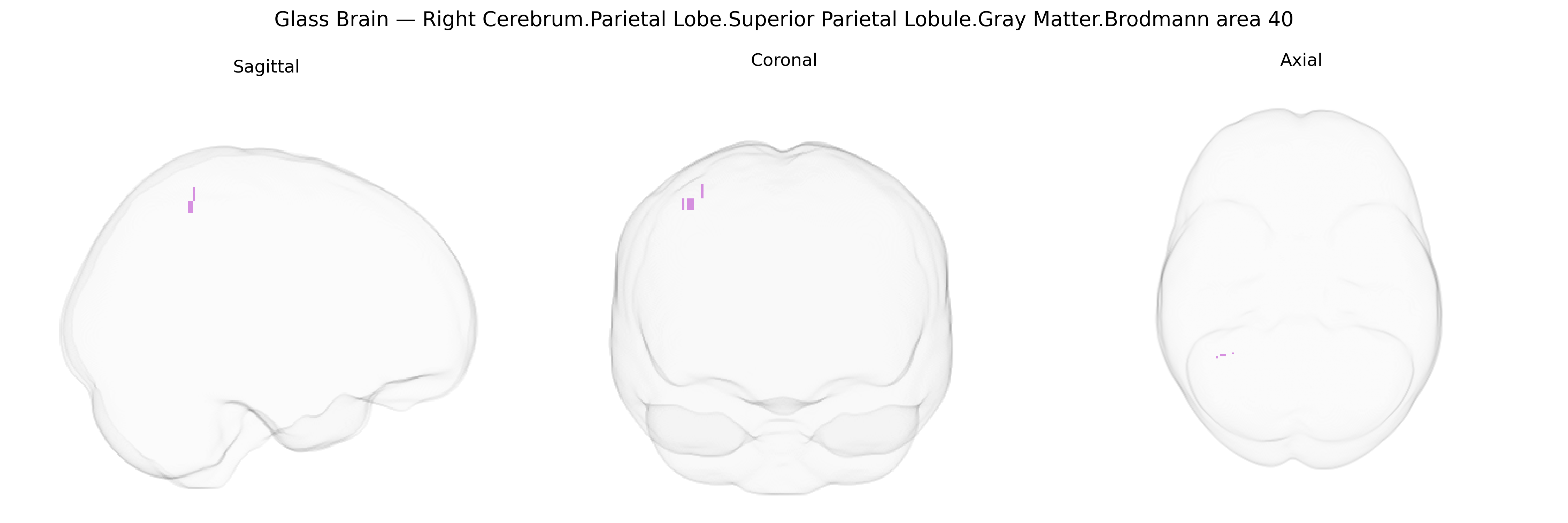 Triplanar Ghost Brain