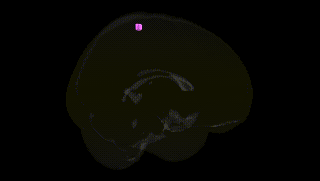 Full Brain Black