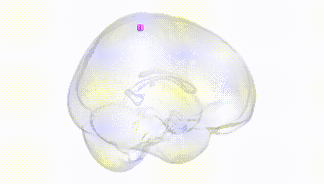 Full Brain White