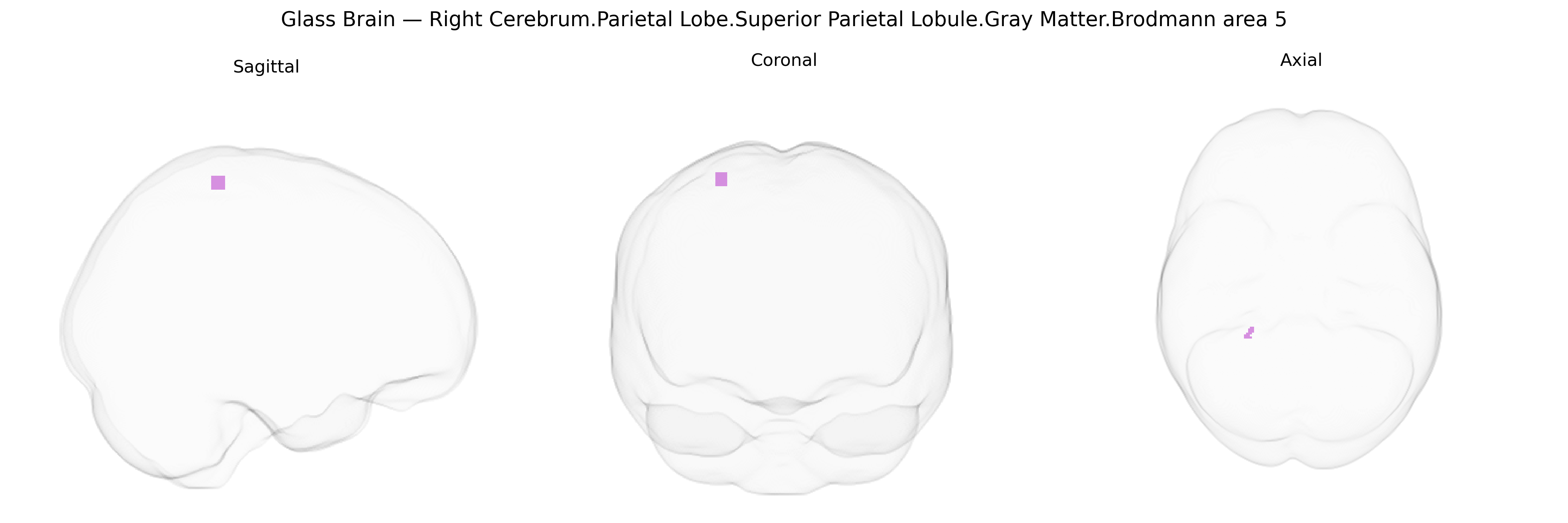 Triplanar Ghost Brain