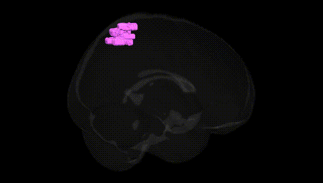 Full Brain Black