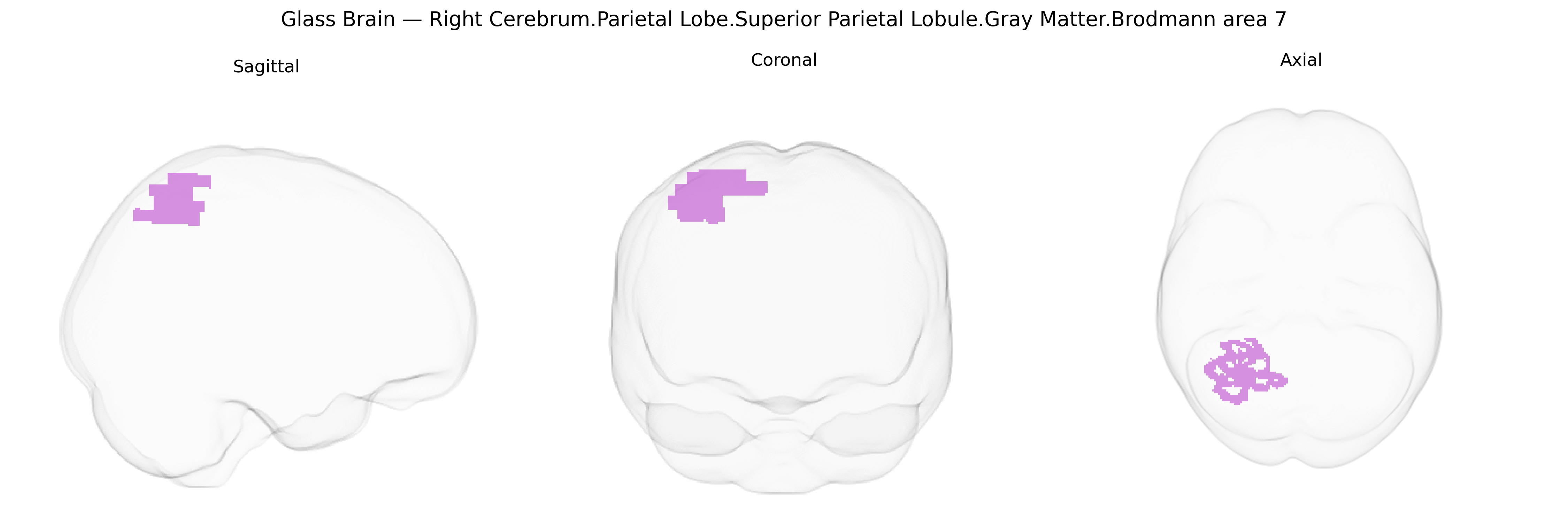 Triplanar Ghost Brain