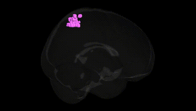 Full Brain Black
