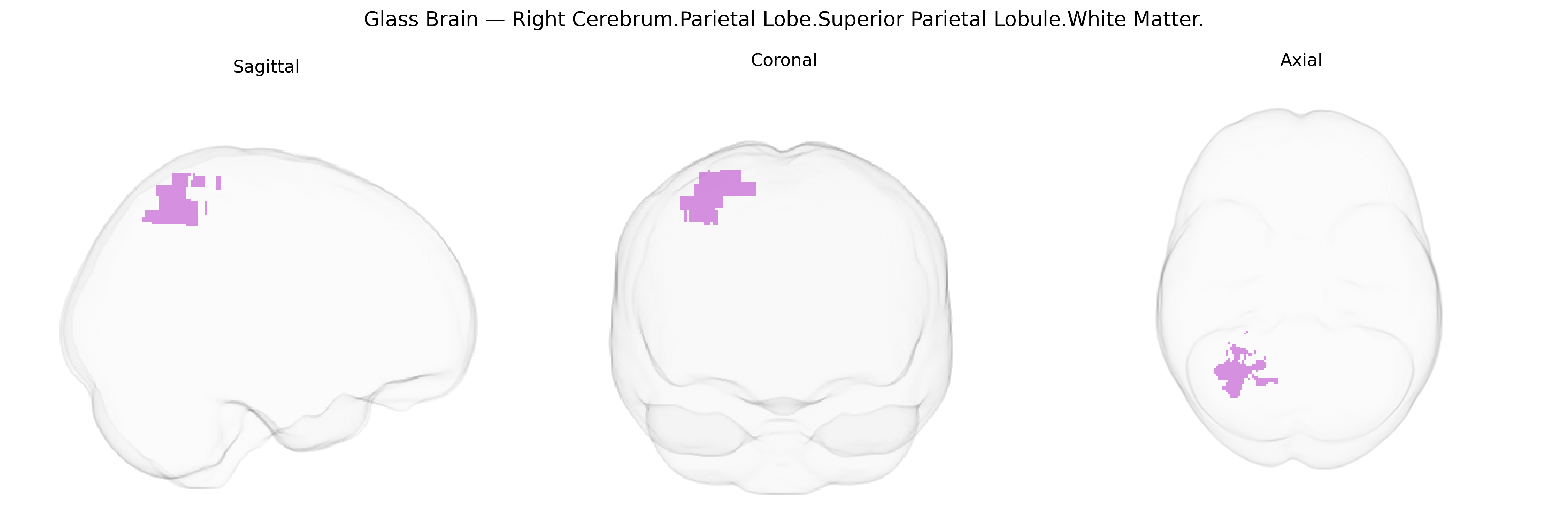 Triplanar Ghost Brain