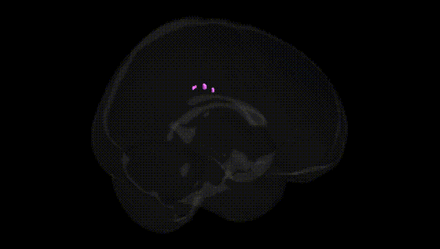 Full Brain Black