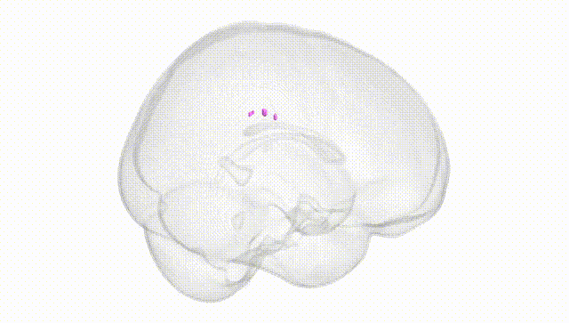 Full Brain White