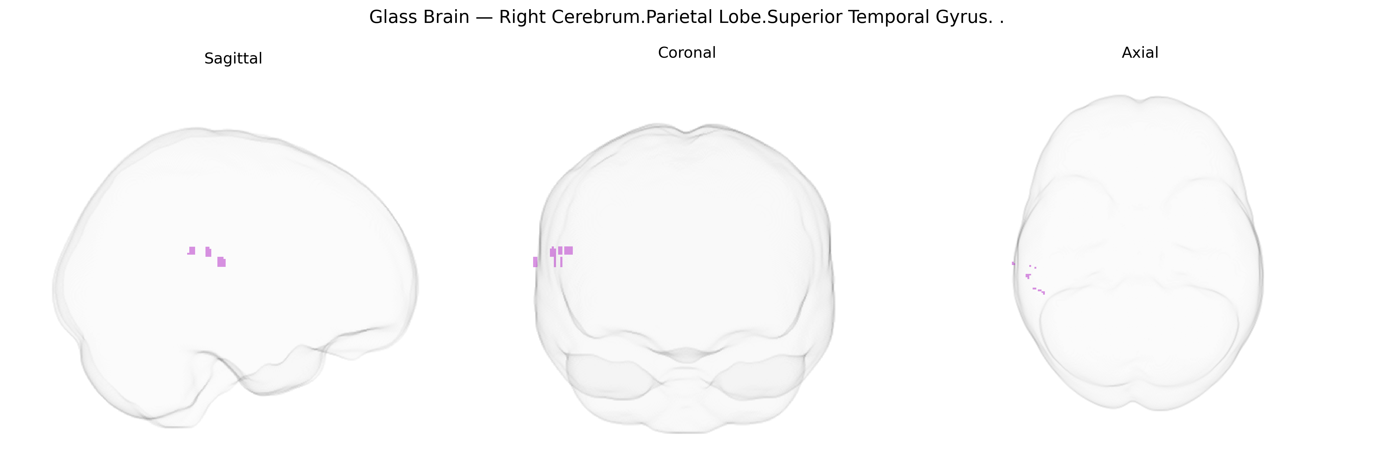 Triplanar Ghost Brain