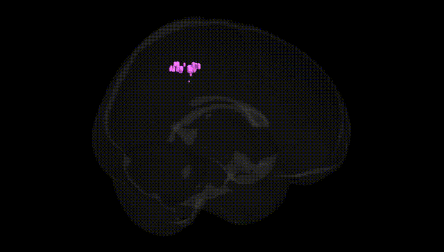 Full Brain Black