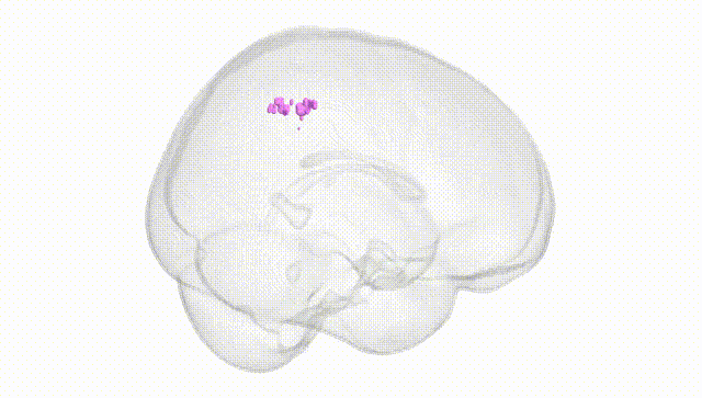 Full Brain White