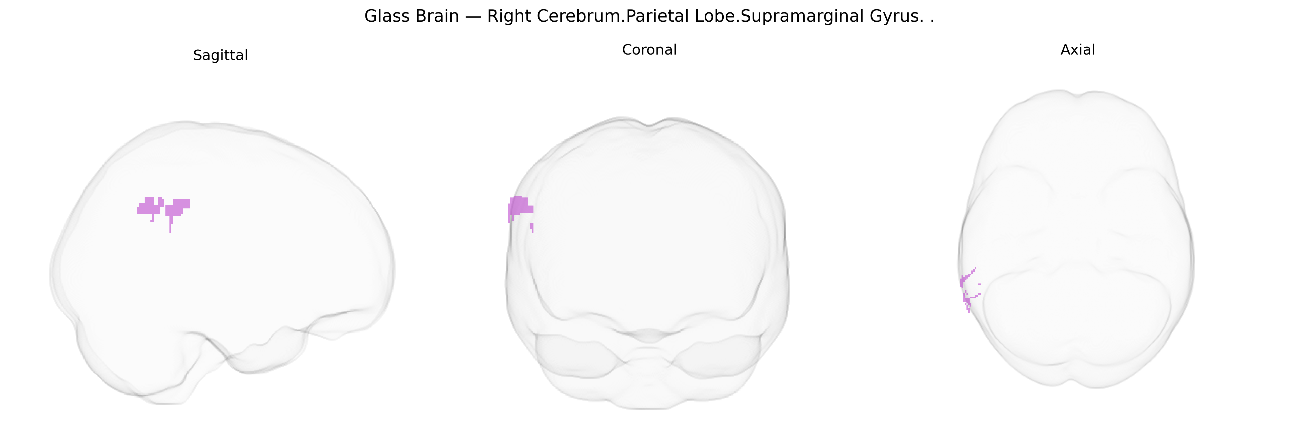Triplanar Ghost Brain