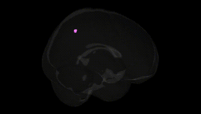 Full Brain Black