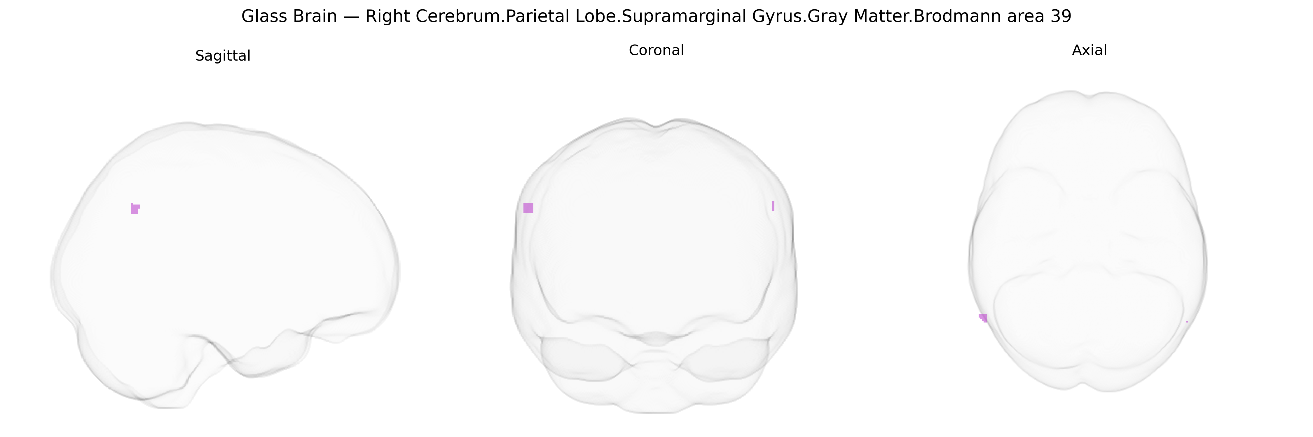 Triplanar Ghost Brain