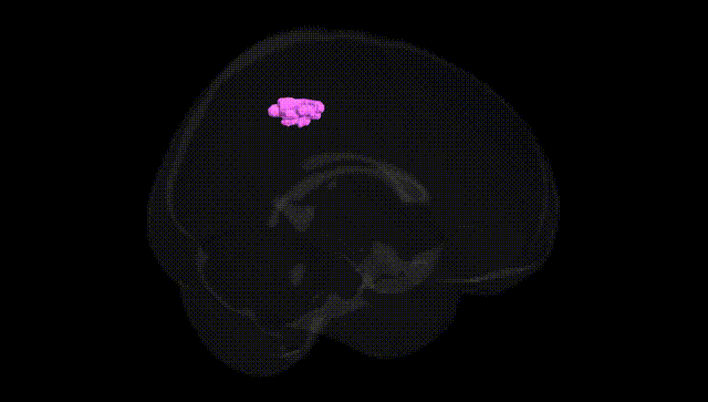 Full Brain Black