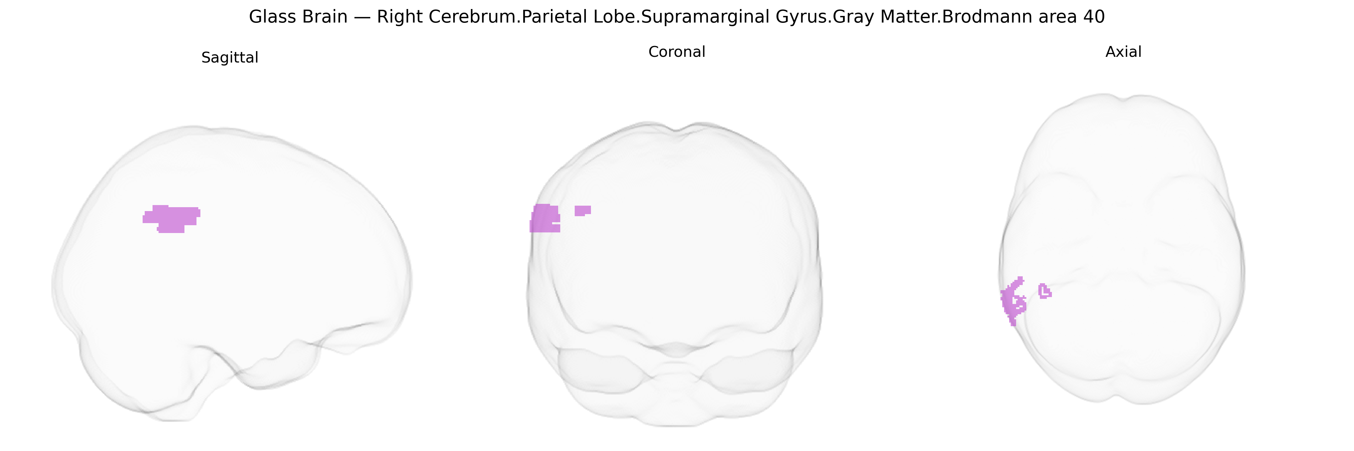 Triplanar Ghost Brain