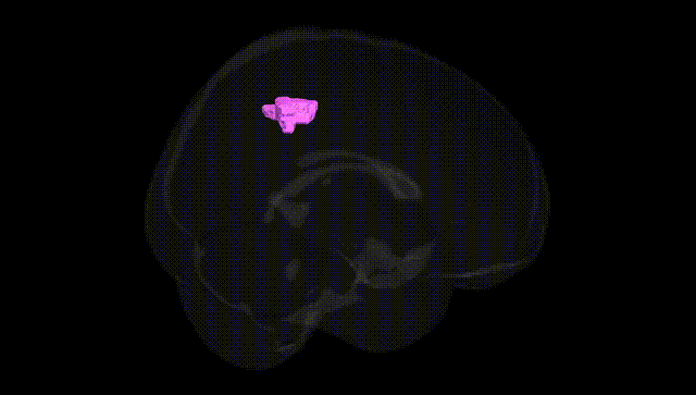 Full Brain Black