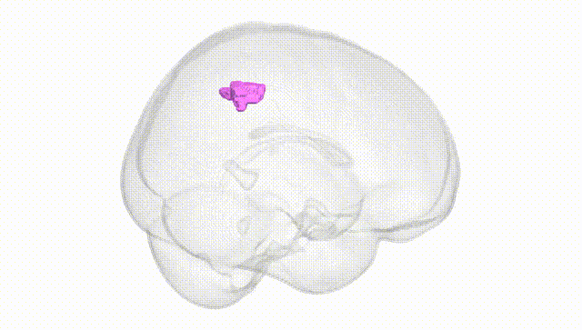 Full Brain White