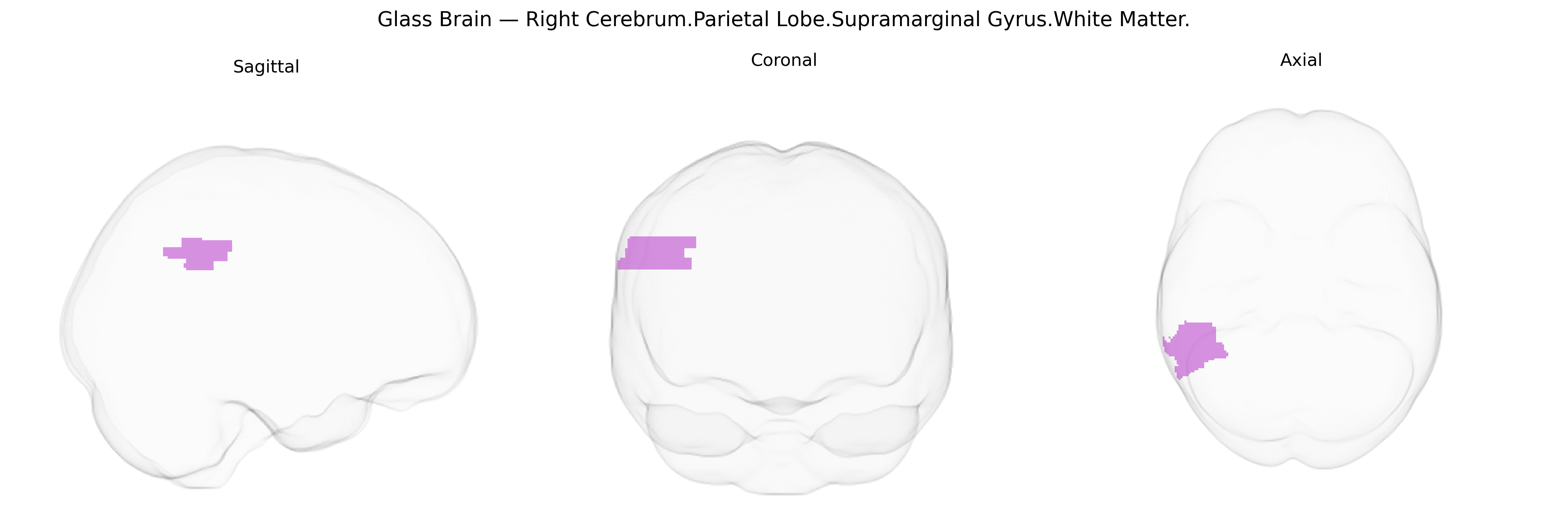 Triplanar Ghost Brain