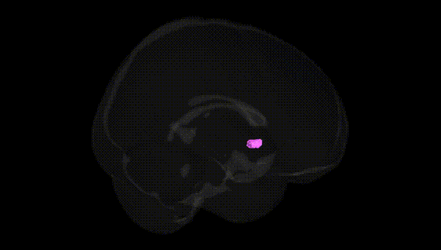Full Brain Black