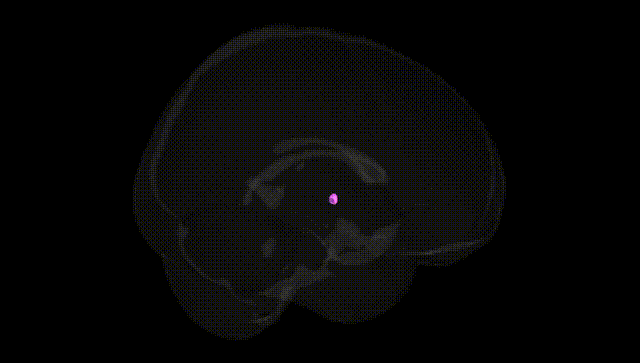 Full Brain Black