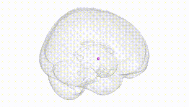 Full Brain White