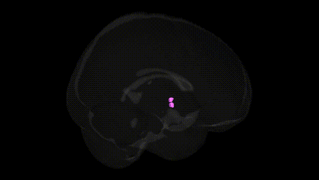 Full Brain Black