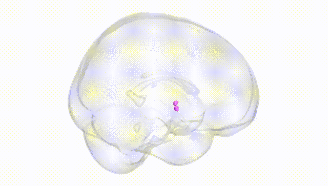 Full Brain White