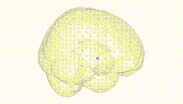 Full Brain White