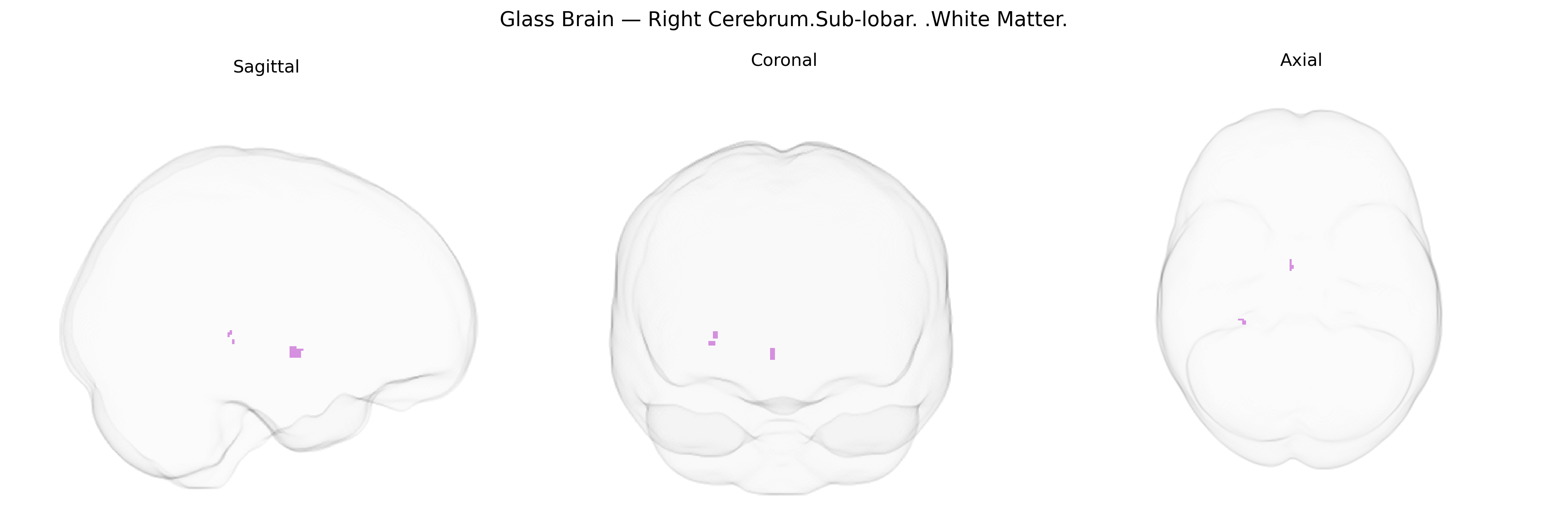 Triplanar Ghost Brain