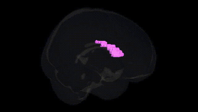 Full Brain Black