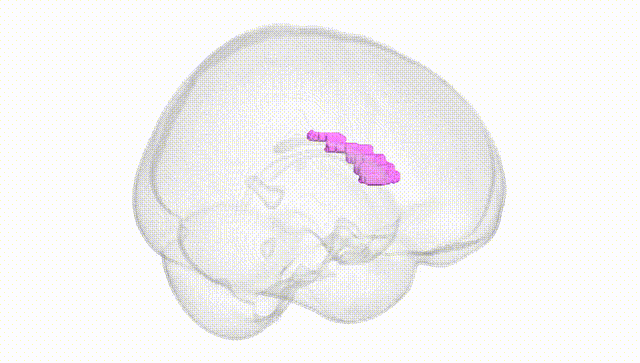Full Brain White