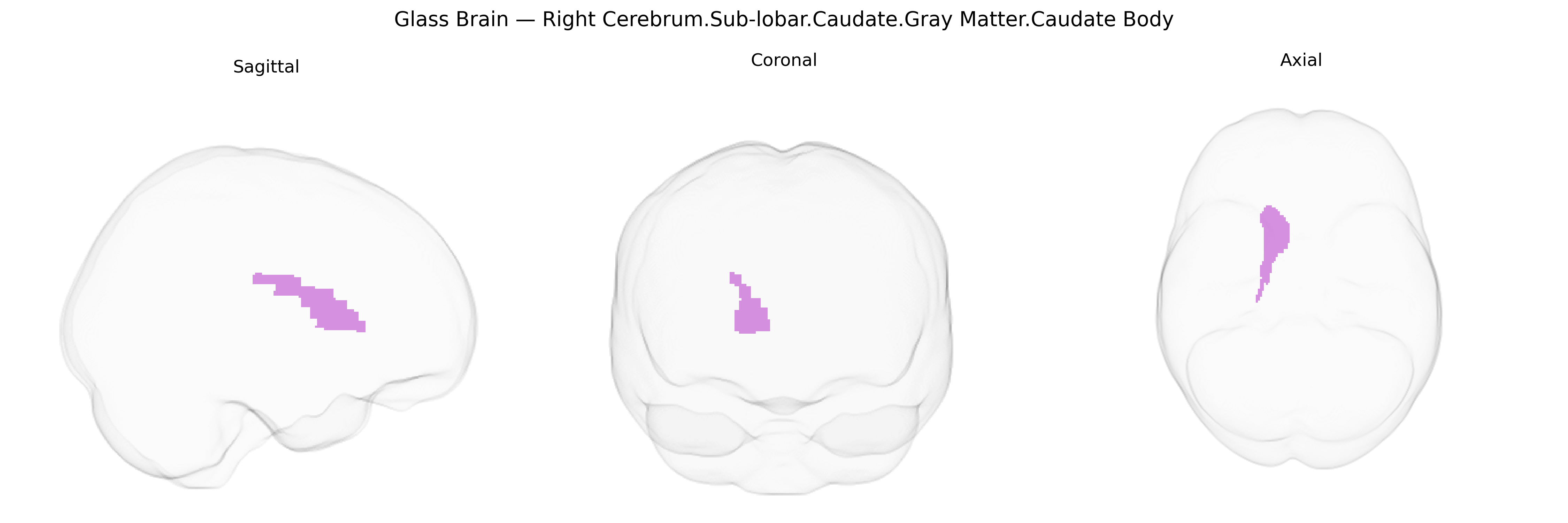 Triplanar Ghost Brain