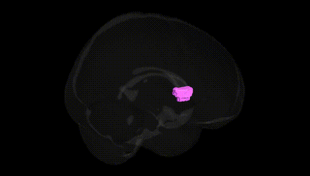 Full Brain Black