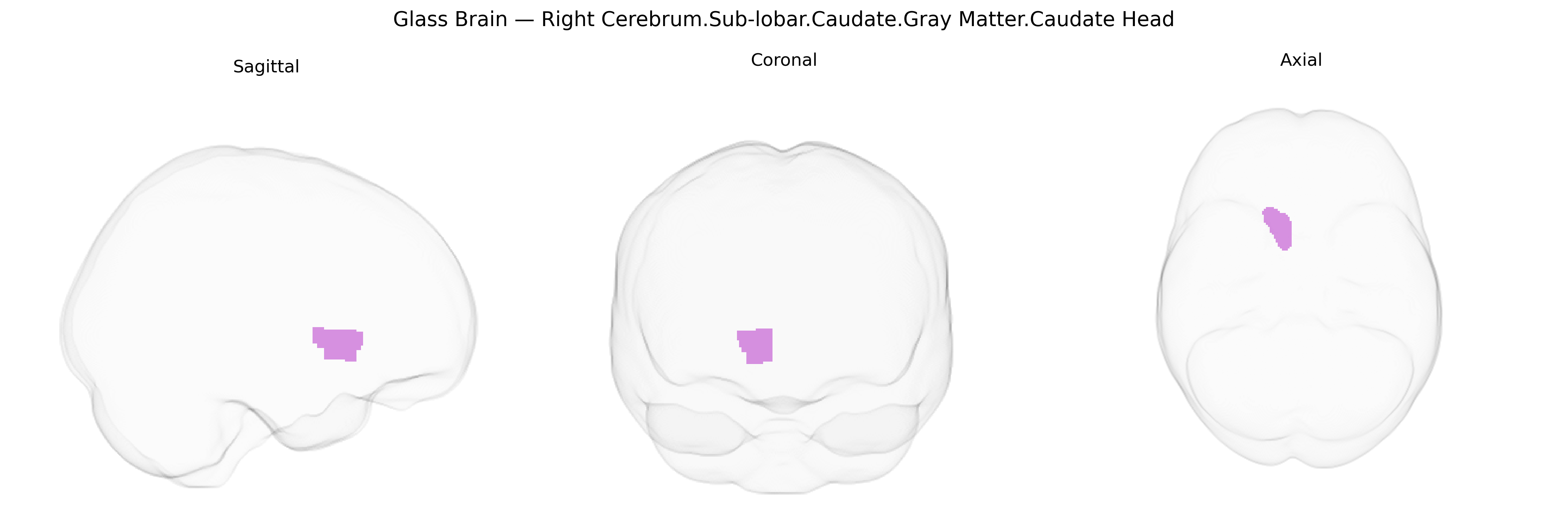 Triplanar Ghost Brain