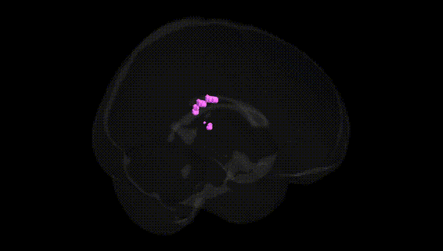 Full Brain Black
