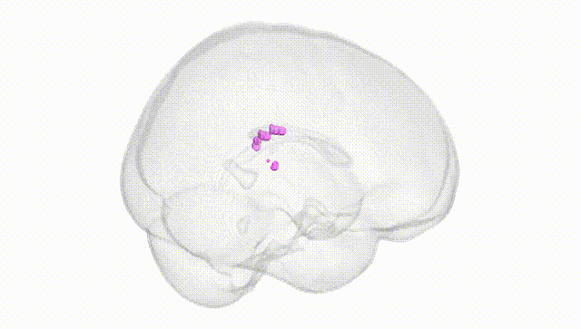 Full Brain White