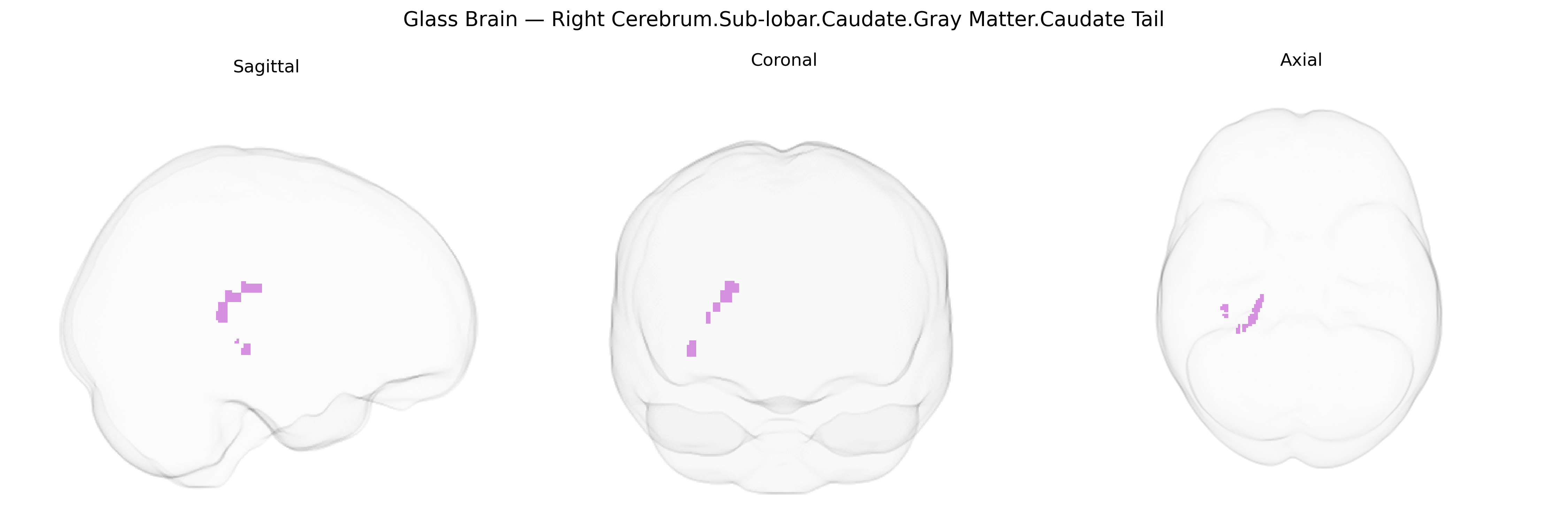 Triplanar Ghost Brain
