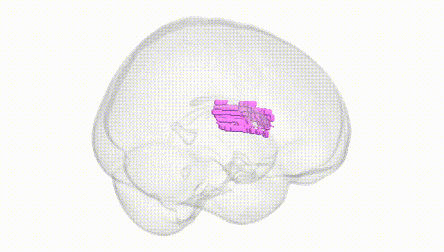 Full Brain White