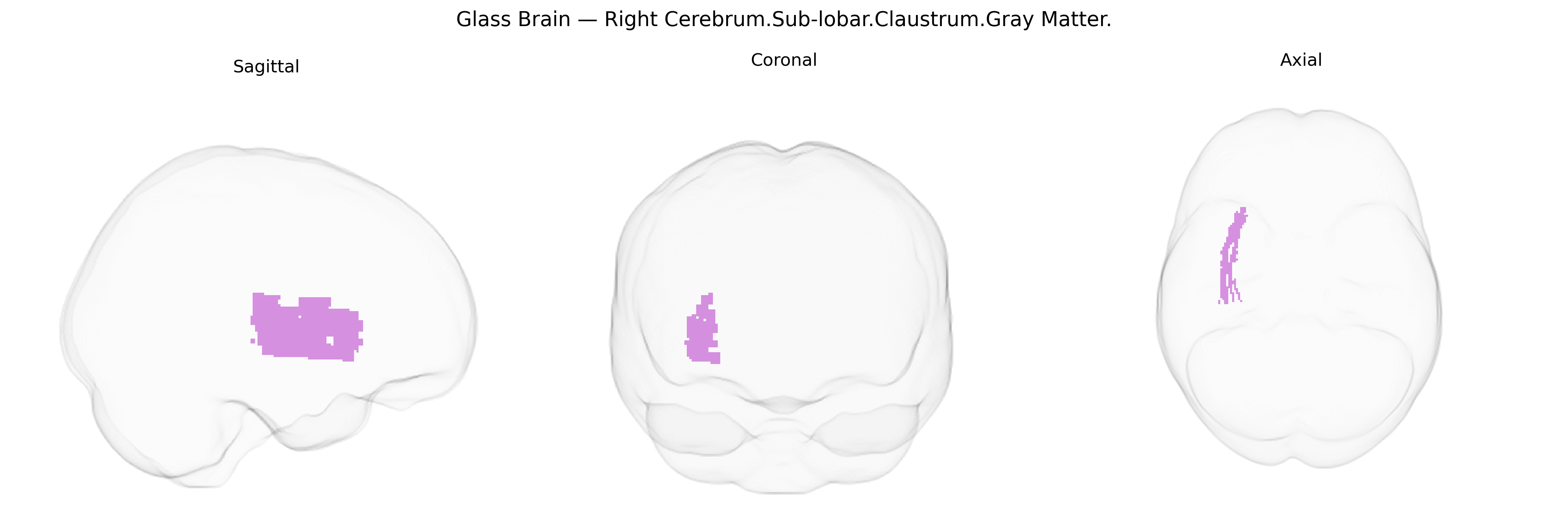 Triplanar Ghost Brain