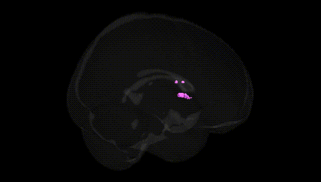 Full Brain Black