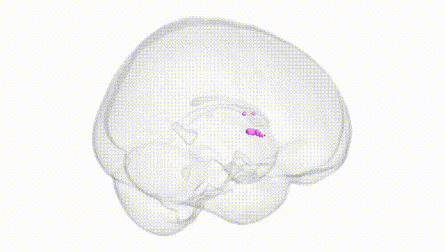 Full Brain White
