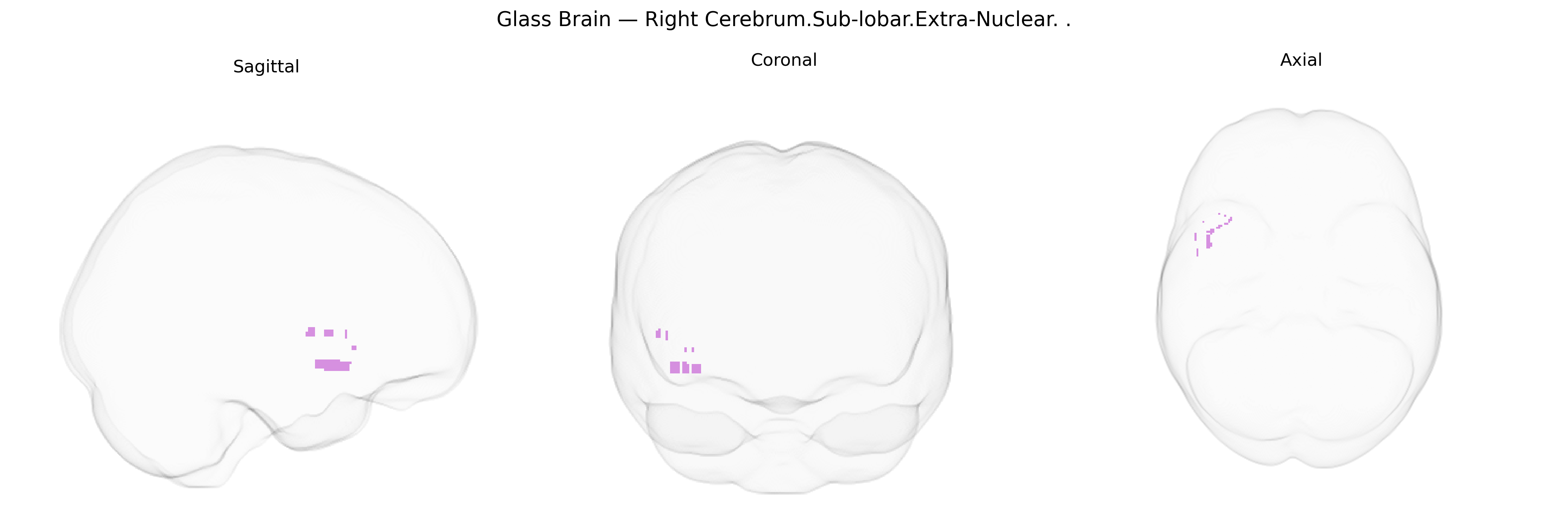 Triplanar Ghost Brain