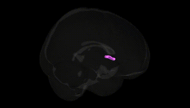 Full Brain Black